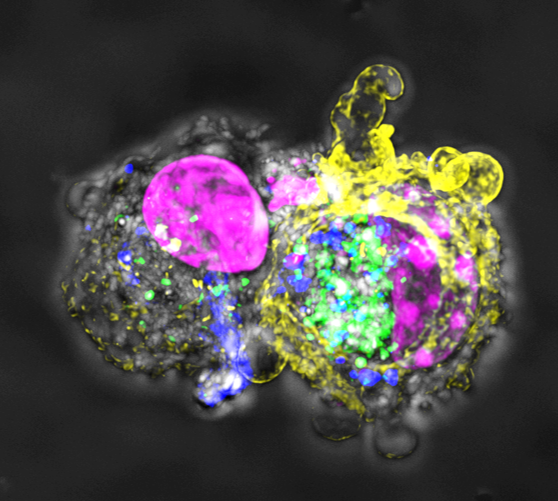 INFECTION AND IMMUNITY (BS5100_1)