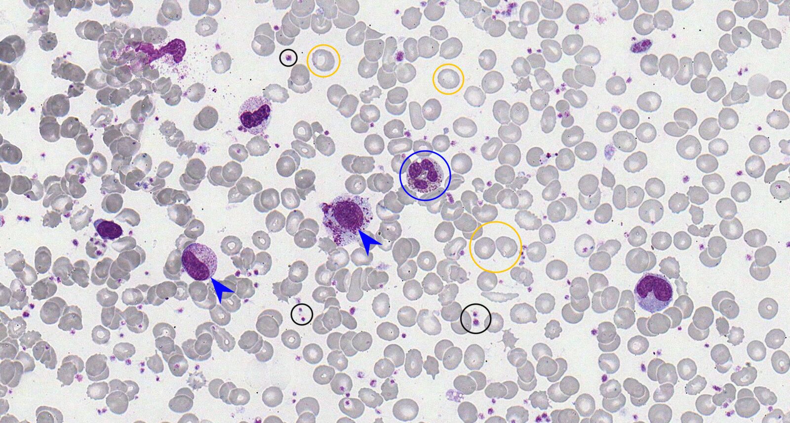 HAEMATOLOGY AND TRANSFUSION SCIENCE (BS5111_1)